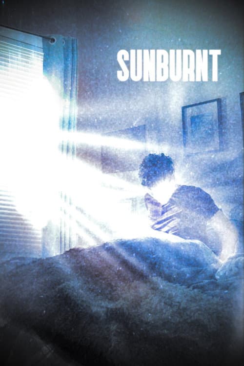 Sunburnt