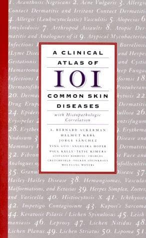 A clinical atlas of 101 common skin diseases